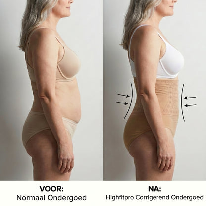 HighFitPro™ | Korrigierende Schlankheitsunterhosen | 2+3 GRATIS